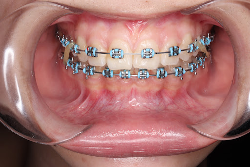 LIHE, Dentista Monterrey - Thumbnail