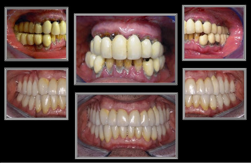 Studio Dentistico Luca' Dr. Roberto - Thumbnail