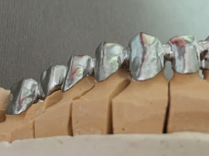 Photo n°14 de DENTIQ@SYSTEM dentaire à Artix (Fabricant d'armatures)