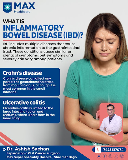 Inflammatory bowel disease (IBD) is a term for two conditions (Crohn’s disease and ulcerative col… post image