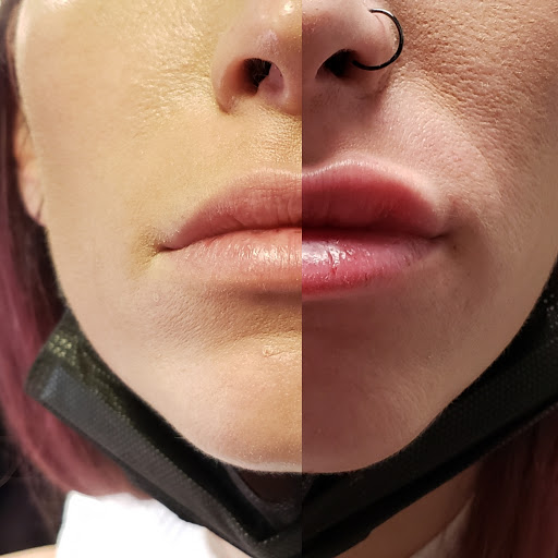 Forever Flawless Aesthetics