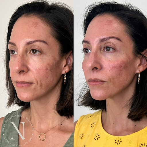 Nevé Aesthetics and Wellness