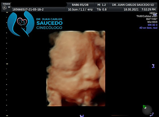 Dr. Juan Carlos Saucedo Ramírez - Thumbnail