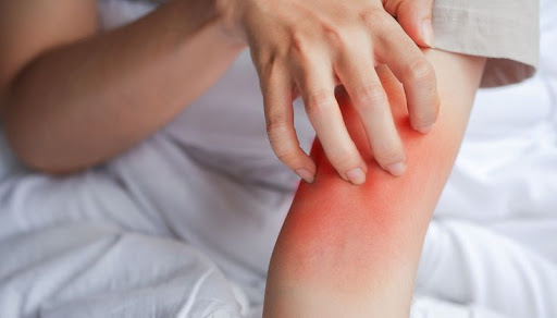 Constant itching, redness, or skin rashes could be signs of 