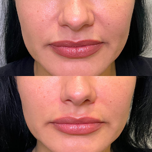 Botoxie - North Park