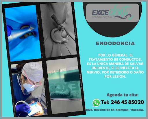 Exedent - Visual