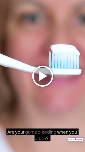 Bleeding gums are NOT normal 🚨 post image