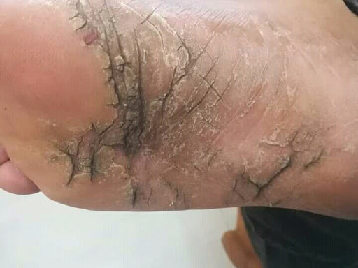 Cured within 21 days  (Dr Soumya Dey's Clinic desk)  post image