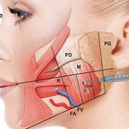 Pretty girls aesthetics Botox And Fillers - Doctor
