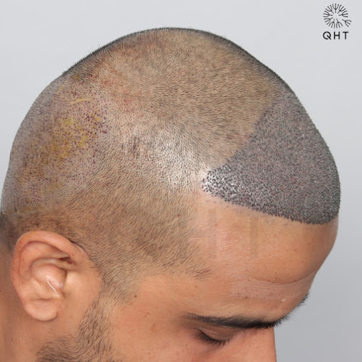 Af1qipprlnz2z6esqr6ranv4hmllfpxhbhmi2zwnewmn=s508 K No