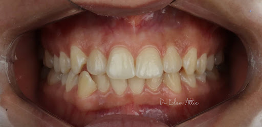 عيادة الدكتور اسلام عطية لتقويم وتجميل الاسنان - صورة 4