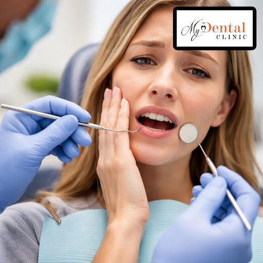 A chipped or broken tooth can be painful and scary, but timely treatment can save your tooth and… post image