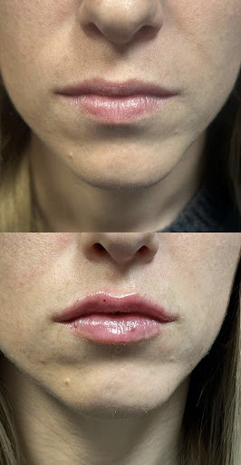 Forever Young Complete Healthcare