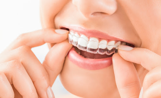 Mequon Smile Design - Thumbnail