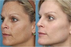 Palma Skin Clinic luton