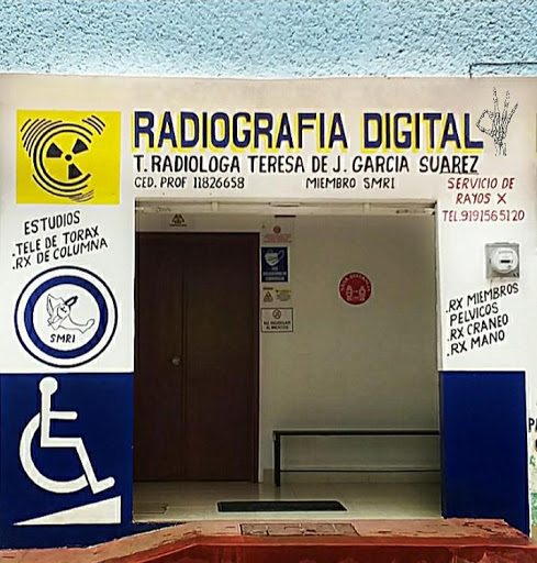 RADIOGRAFIA DIGITAL TAPILULA - Thumbnail