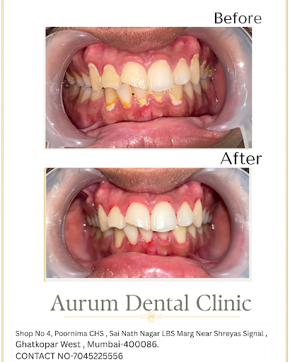 A Cleaner smiles starts with healthier gums 🦷✨
