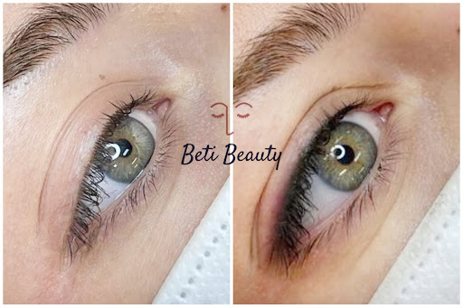 Beti Beauty estética - Thumbnail