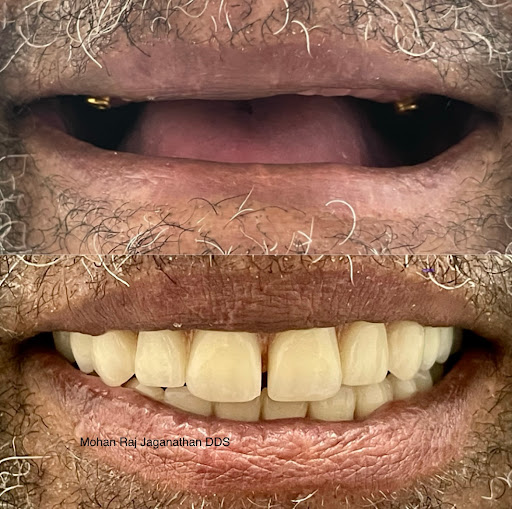 Elite Dental - Mohan Raj Jaganathan DDS & Veena Raja DDS PhD Photo