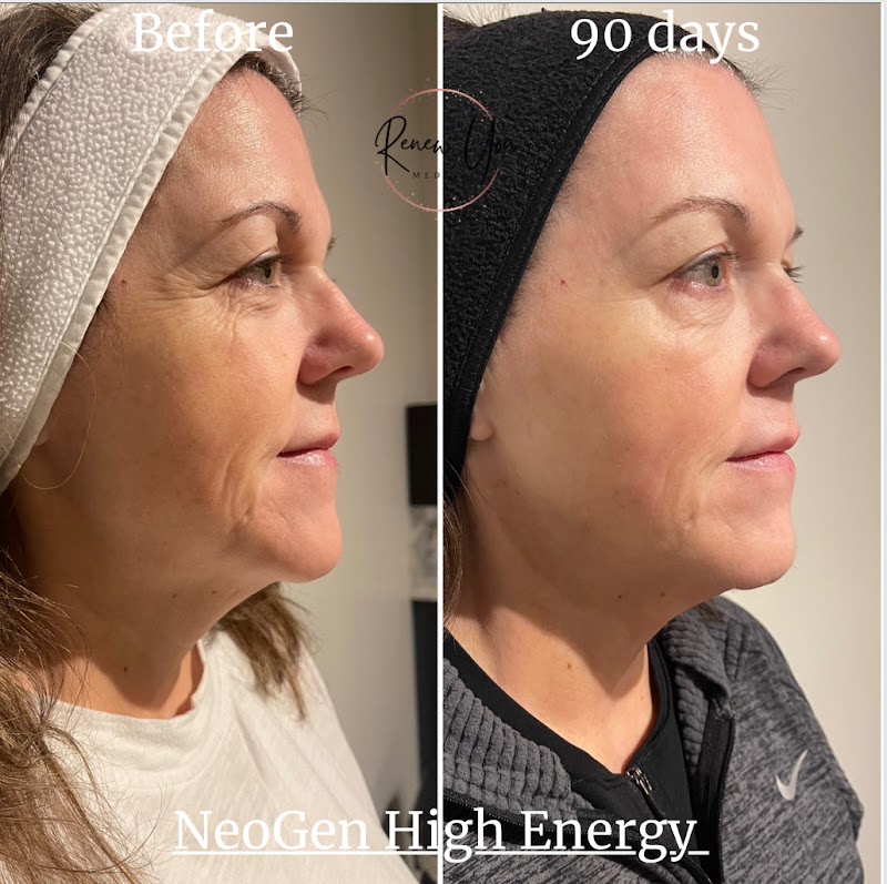 Renew You MedSpa & IV Bar