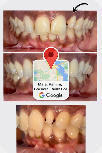 ✨ Smile Transformation in Progress post image