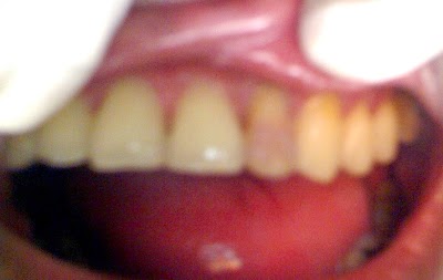 Photos of U-Smile Family Dental Practice