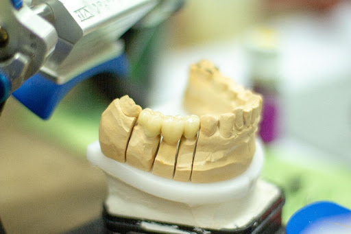 Dental Service - Thumbnail