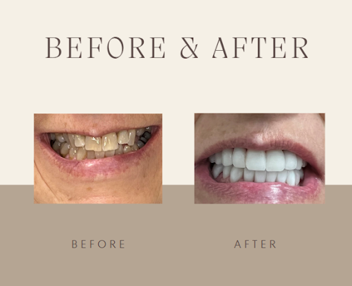 Sanger Dental at the Basin