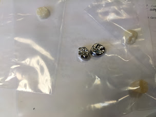 Photo n°4 de Ysil dentaire à Longwy (Centre de prothèses dentaires)