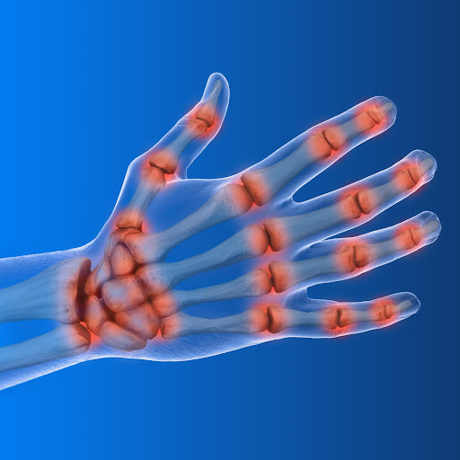 Waking up with stiff and painful joints is common, but if the stiffness lasts for a long time eve… post image