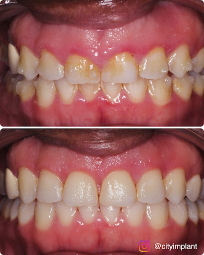 Better Living through Dentistry : Queens