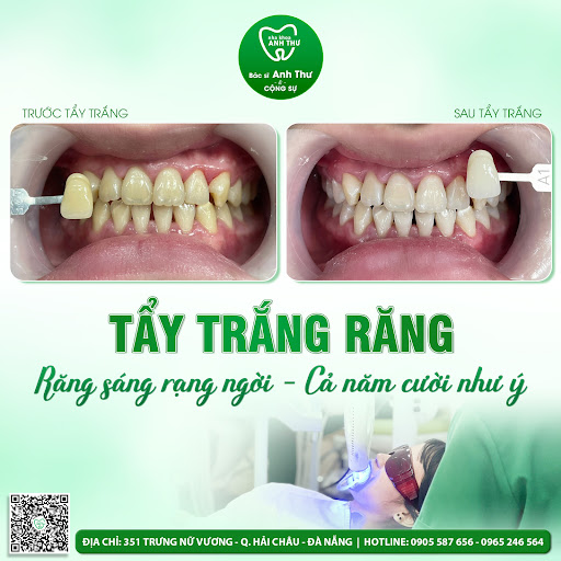 Nha Khoa Anh Thư photo 4