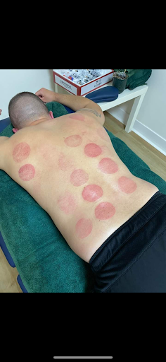 Active release Therapy - Thumbnail