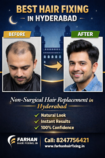 Get a natural and confident look with our non-surgical hair replacement in Hyderabad. post image