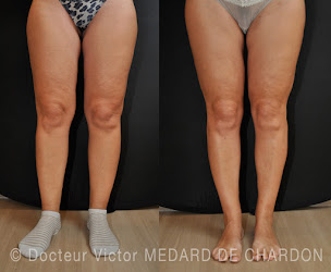 Photo n°20 de Dr. Victor MEDARD DE CHARDON à Cannes (Clinique de chirurgie plastique)