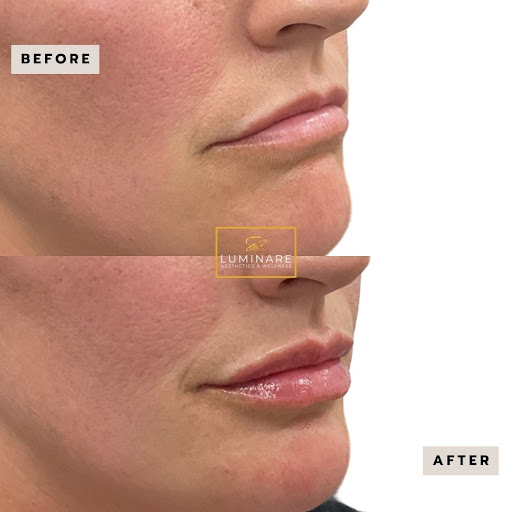 Luminare Aesthetics & Wellness, LLC