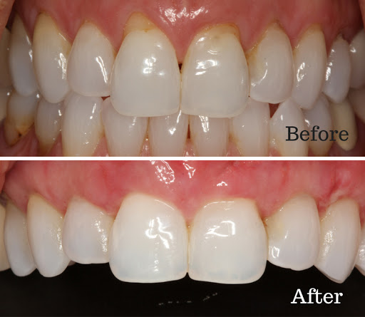 Mission Dental Implant Center - Thumbnail