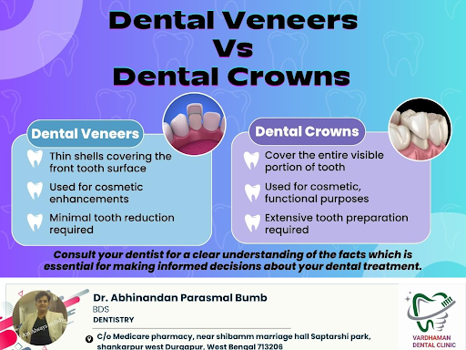Dental Veneers Vs Dental Crowns post image