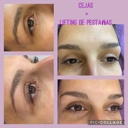 Estetica Aroa - Thumbnail