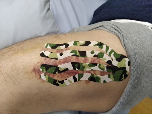 Fisioterapia MAR - Thumbnail