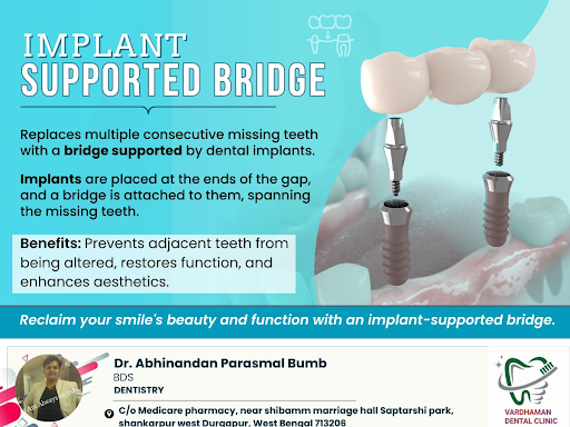 An implant-supported bridge is a dental solution for replacing multiple missing teeth. Unlike tra… post image