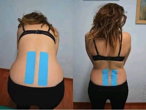 Fisioterapia a domicilio FisioToGo - Thumbnail
