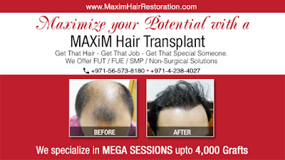 Photos of MAXIM Hair Restoration