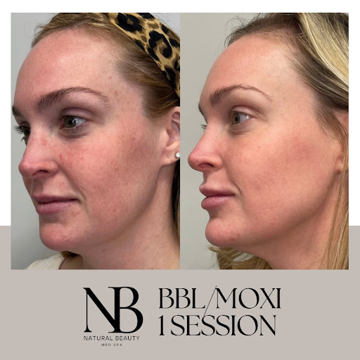 The Natural Beauty Med Spa - Thumbnail