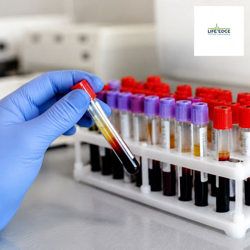 Serology tests play a crucial role in detecting infections early and accurately. At Life Edge Cli… post image