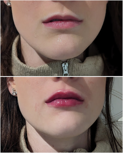 Vassthetics Aesthetics