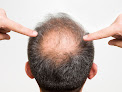 Hair transplant clinic Shapiro Medical Group | Hair Restoration | Minneapolis, Mn in Minneapolis
