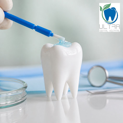 Fluoride treatment is one of the simplest and most effective ways to protect your teeth from cavi… post image