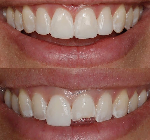 Smile Essentials - Visual