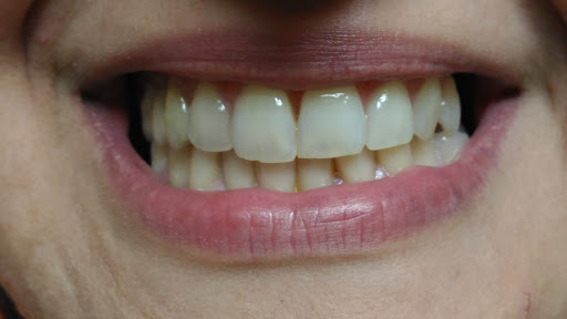 Studio Dentistico Lomunno - Thumbnail
